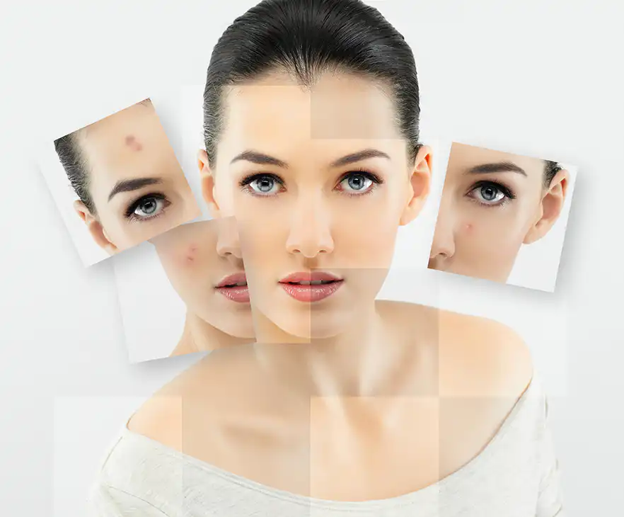 Hautprobleme? 1 wellness hautpflege bremen - Hautprobleme?