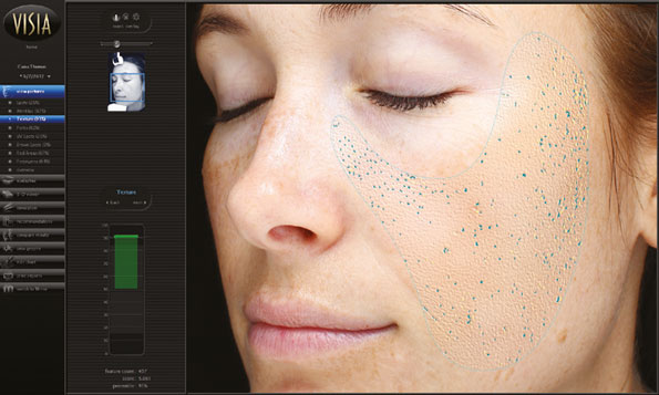 VISIA® GEN7 – HAUTANALYSE