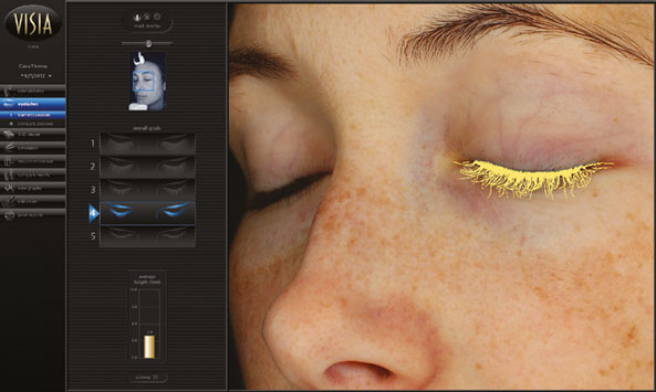 VISIA® GEN7 – HAUTANALYSE