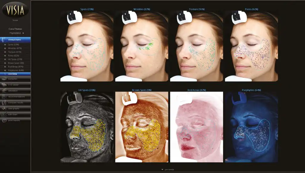 VISIA® GEN7 – HAUTANALYSE