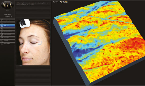 VISIA® GEN7 – HAUTANALYSE